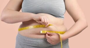 Obesity